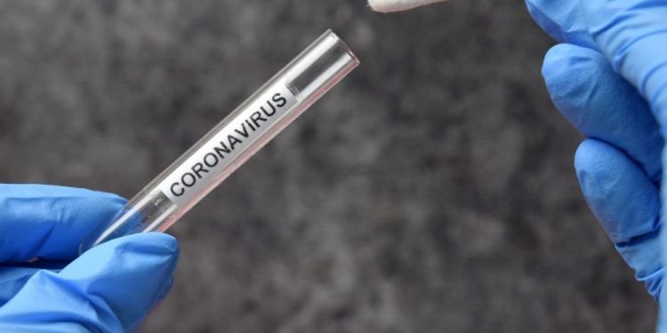 Per praėjusią parą patvirtinti 1773 nauji koronavirusinės infekcijos atvejai, 15 mirė Per praėjusią parą patvirtinti 1773 nauji koronavirusinės infekcijos atvejai, 15 mirė