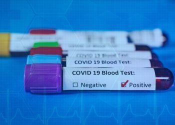 COVID-19: praėjusią parą nustatyta 2360 naujų atvejų, mirė 36 žmonės