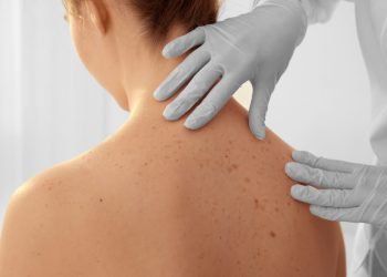 Gydytoja Dermatovenerologė Atsako į 5 Dažniausius Klausimus Apie Grožio Injekcijas