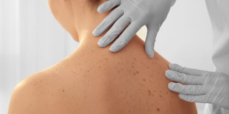 Gydytoja Dermatovenerologė Atsako į 5 Dažniausius Klausimus Apie Grožio Injekcijas