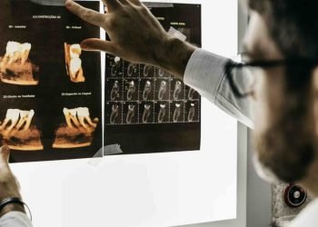 Dantų implantai ką žinoti?