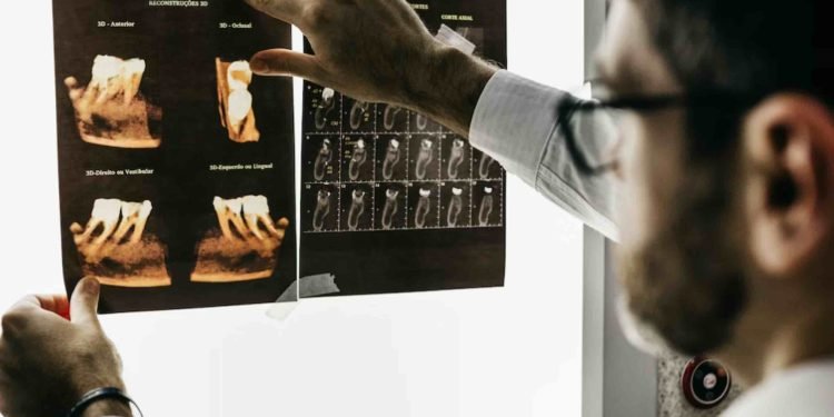 Dantų implantai ką žinoti? Dantų implantai ką žinoti?