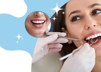 Kaip palaikyti tinkamą burnos ertmės higieną?